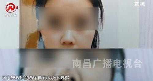 南昌医美爆料事件视频最新,真相触目惊心  第2张